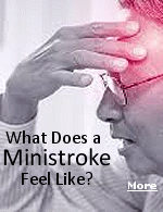 Ministrokes are brief episodes of low blood flow to the brain that resolve on their own. They're also called transient ischemic attacks (TIAs). TIAs resolve on their own within 5 to 10 minutes. But they can also last as long as 24 hours. Ministrokes don't cause lasting damage to the brain. But they're an important warning that you're at high risk of developing a stroke in the near future.